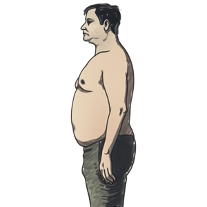 Large Stomach